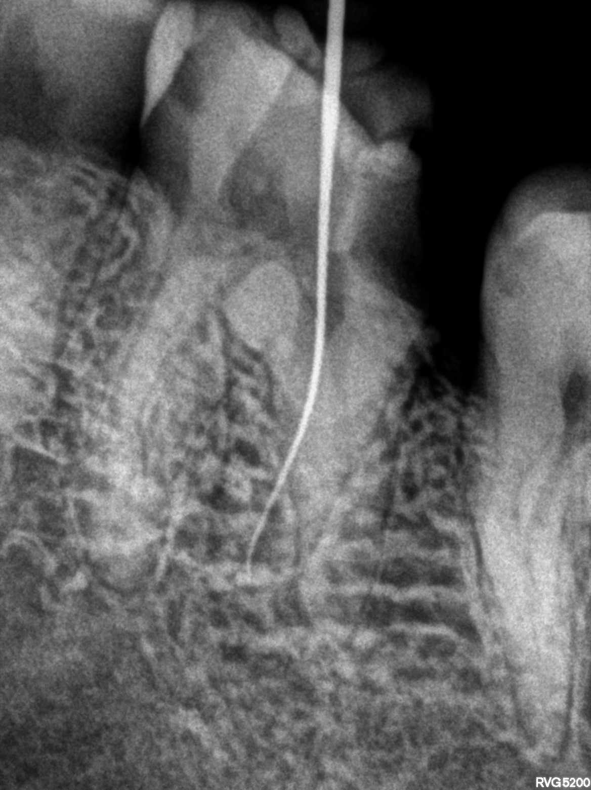 Dental X-ray